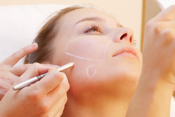 Rosacea behandeling Rosacea behandeling