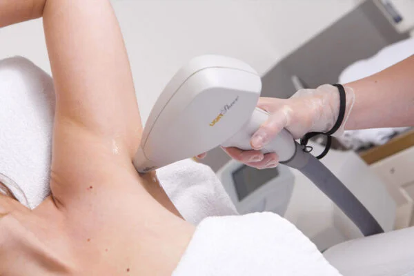 Definitief ontharen lichaam