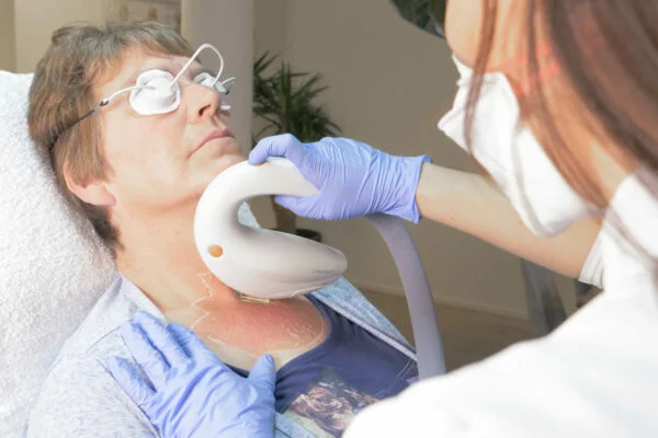 IPL behandeling IPL behandeling