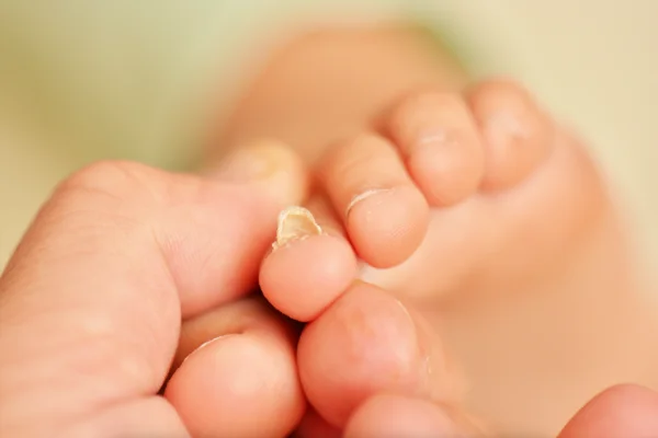 Schimmelnagels Schimmelnagels