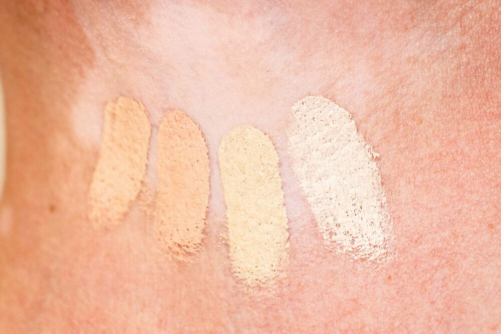 zoeken naar kleur bij camouflage camouflagetherapie