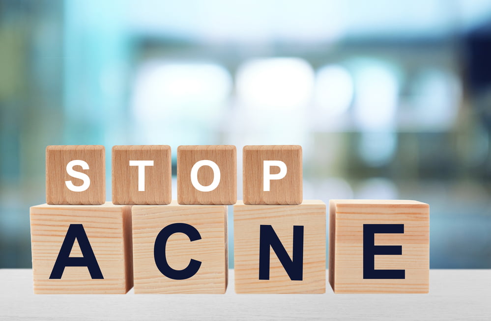 stop acne