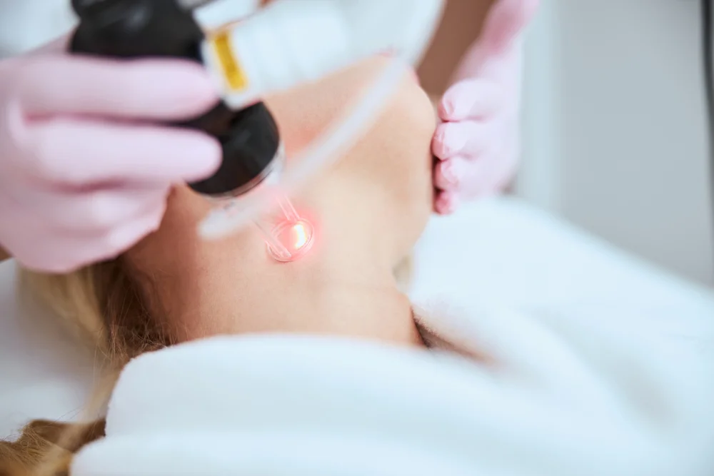 Behandeling met Fractional laser